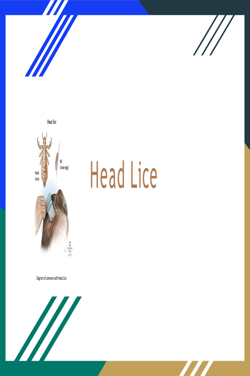 Head Lice Presentation; What Causes head Lice and What are Ways to Stop it from Spr